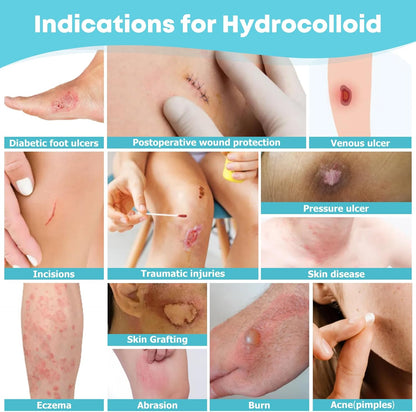 Hydrocolloid Roll