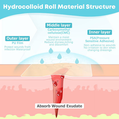 Hydrocolloid Roll