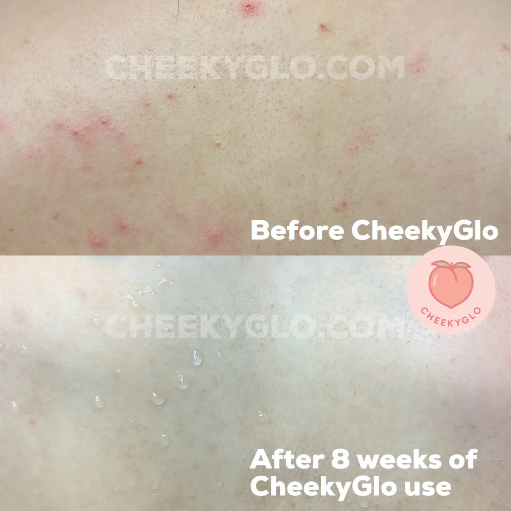 Smooth Skin Magic Mitt