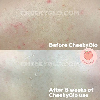 Smooth Skin Magic Mitt