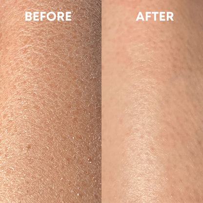 Smooth Skin Magic Mitt